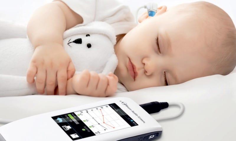 انجام تست OAE