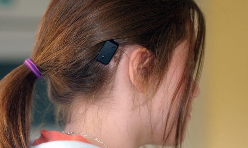 سمعک استخوانی قابل کاشت